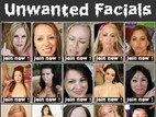 Unwanted Facials