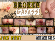 Broken gay ass